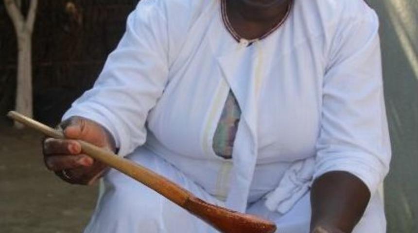 (&ouml;zel Haber) Damaklarındaki Acı Hikaye