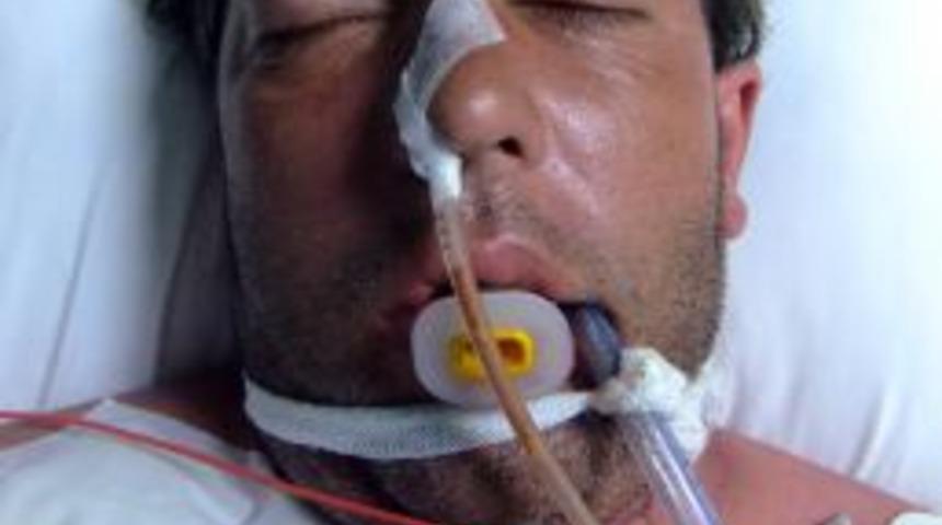 Polonyalı Turistin Y&uuml;z&uuml; T&uuml;rk Gence Nakledilecek