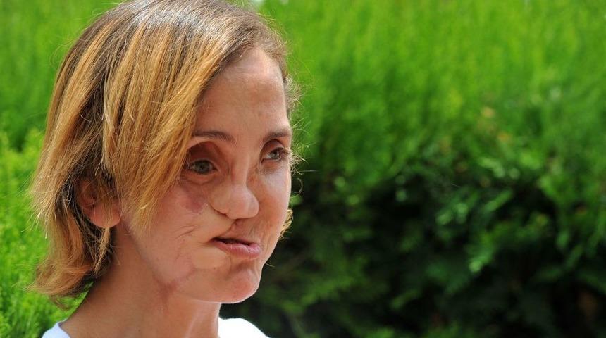 İki Haftadır Nakil Bekleyen Selvinaz: Bana Mı Yapılacak Diye D&uuml;ş&uuml;nd&uuml;m