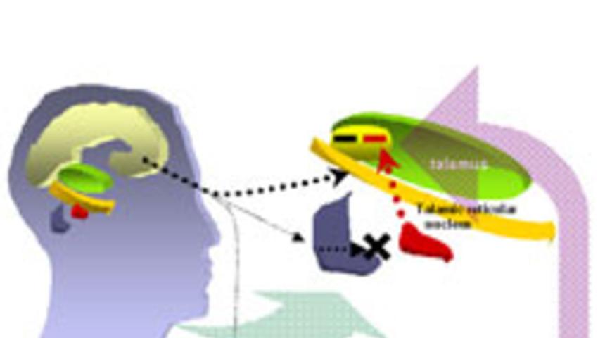 İktidarsızlık Neurofeedback ile Tarih Oluyor!