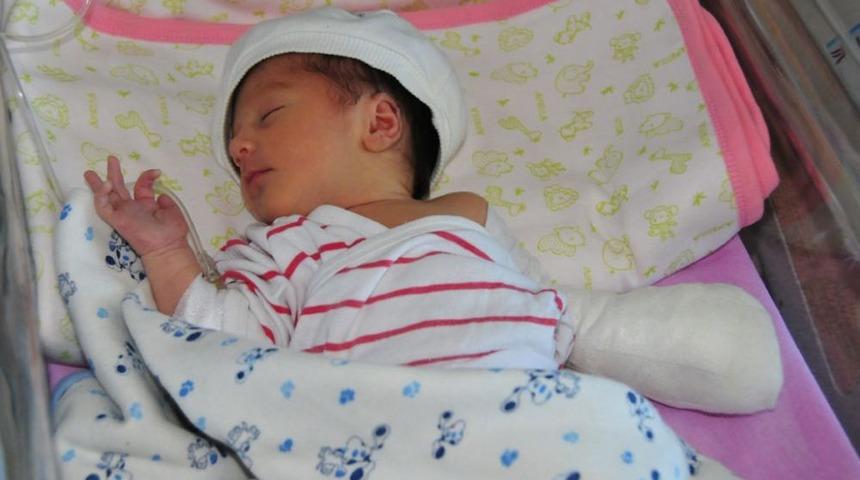 6 G&uuml;nl&uuml;k Bebeğin Makasla Kesilen Parmağı Yerine Dikildi