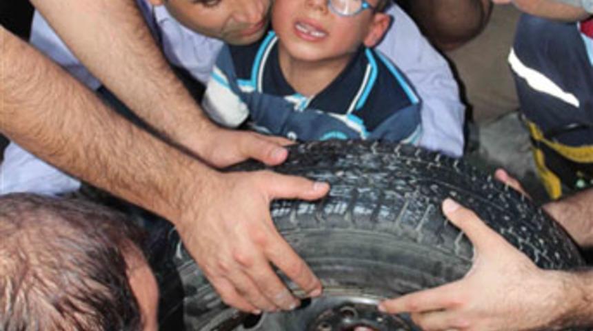 Bijon deliğinden parmak kurtarma operasyonu