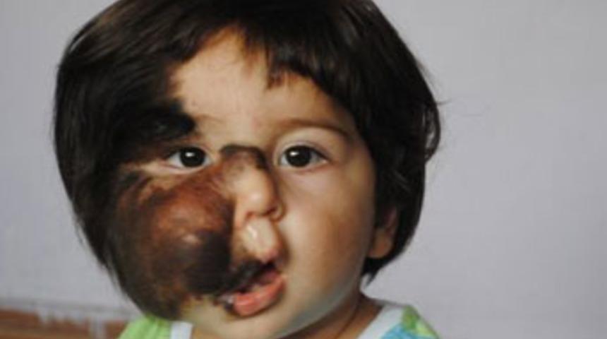 Minik Salih'e ameliyat masasında k&ouml;t&uuml; haber