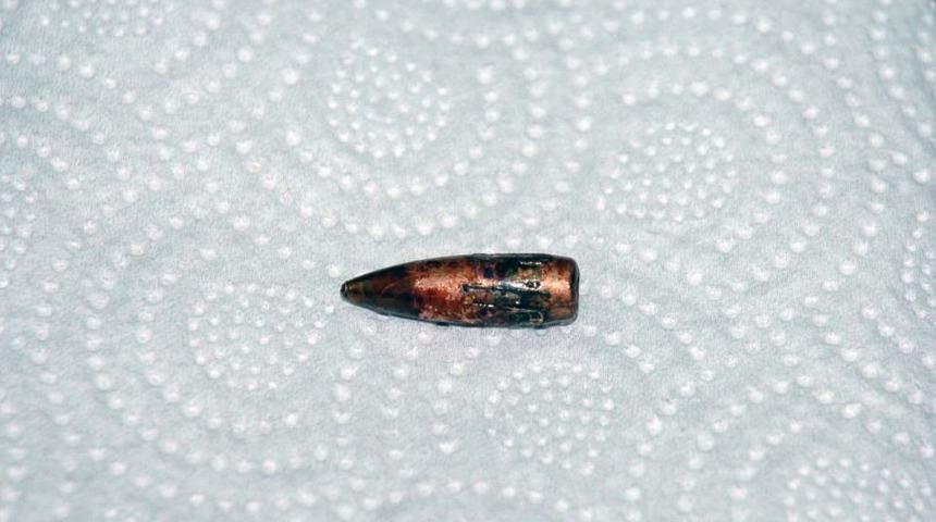 Boynundaki kurşundan 4 ay sonra kurtuldu