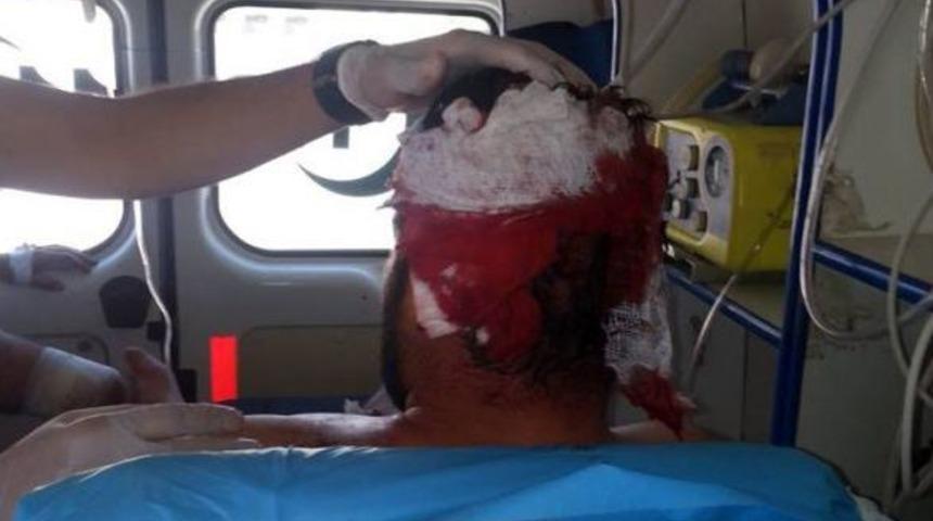 Suriye'den 10 Yaralı Getirildi