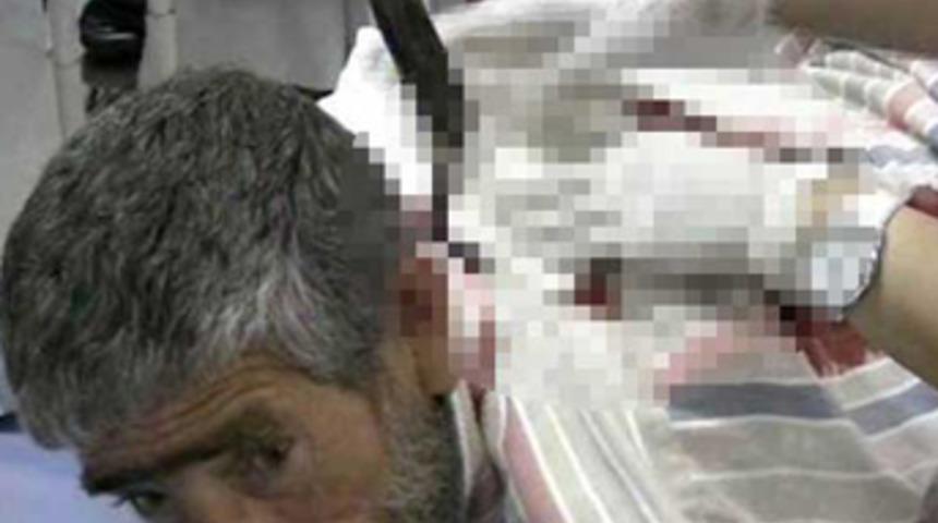 Sırtında bı&ccedil;akla hastaneye getirildi