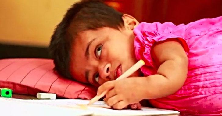 19 yaşında ama bebek vücuduna sahip