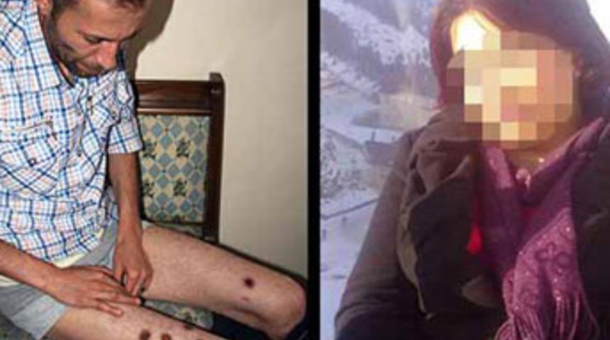 Kocasının v&uuml;cudunda sigara s&ouml;nd&uuml;rd&uuml;