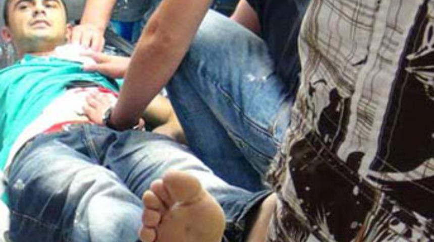 Markette kız kavgası: 4 yaralı