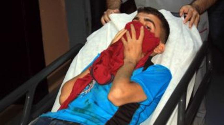 Ter&ouml;r &Ouml;rg&uuml;t&uuml; Yandaşlarının Attığı Bomba Sokaktan Ge&ccedil;en Genci Yaraladı