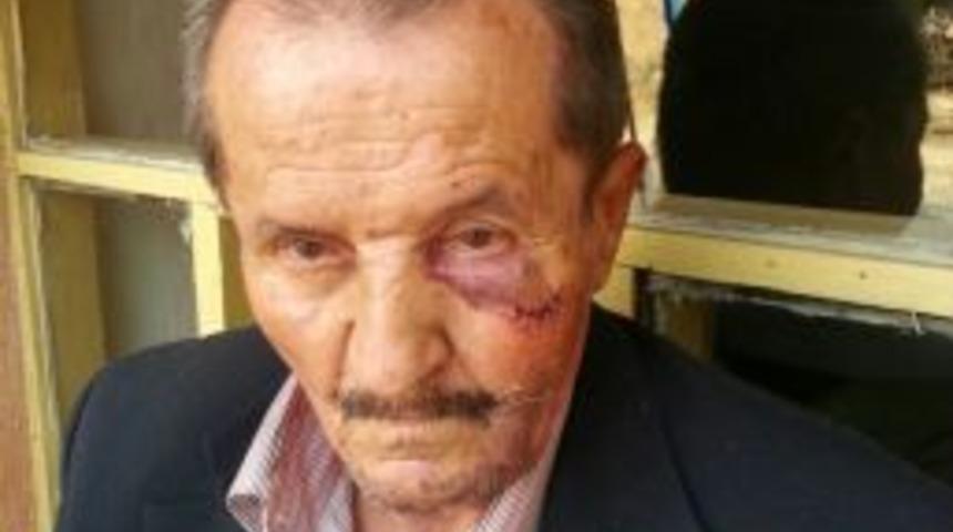 70 Yaşındaki Engelli Vatandaşı 50 Lira I&ccedil;in Darp Ettiler