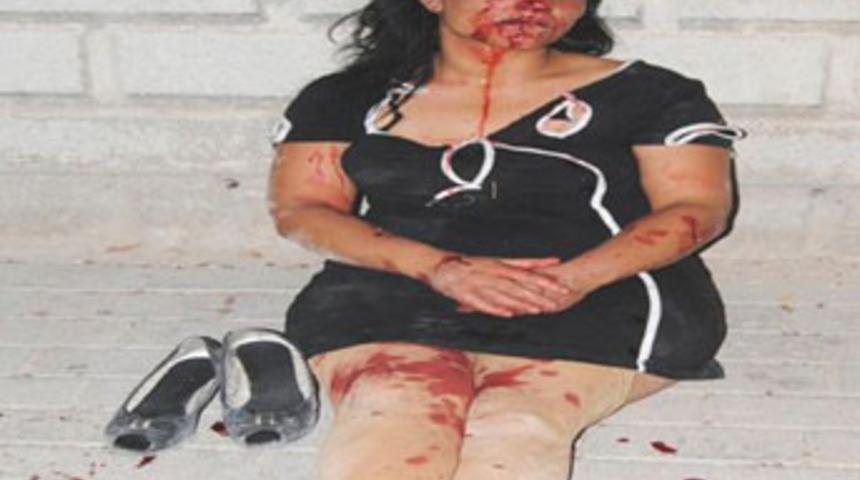 TIR şof&ouml;r&uuml; sevgiliden bayıltan dayak