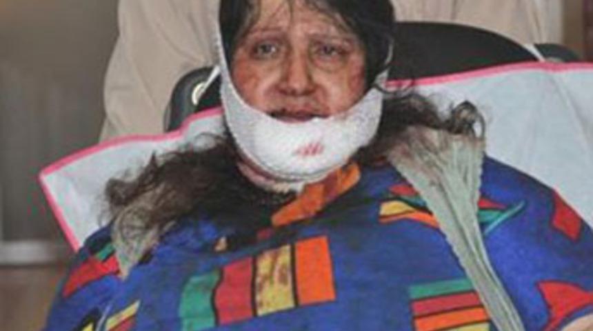 Sivas'ta akıllara durgunluk veren olay