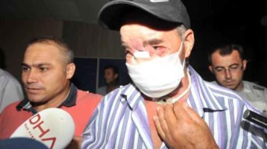 THY Uçağı, Yüz Nakli Yapılacak Hastayı Bekledi