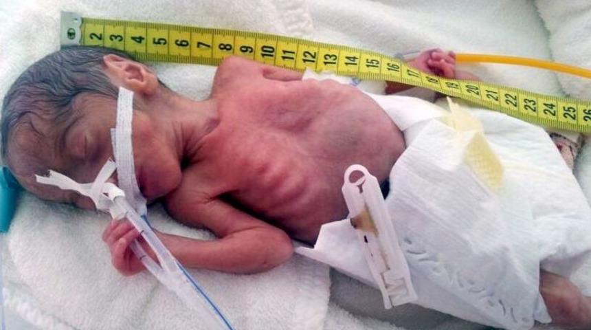 Parmak bebek taburcu edildi