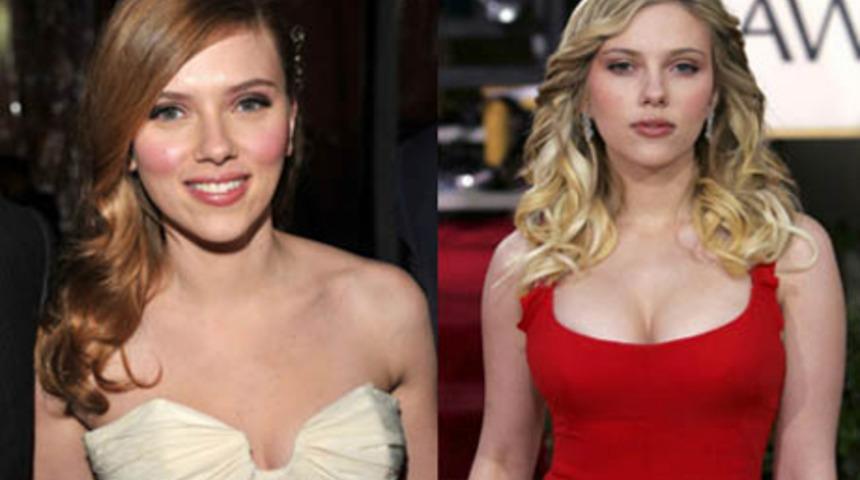 Ünlülerin silikon öncesi ve sonrası halleri