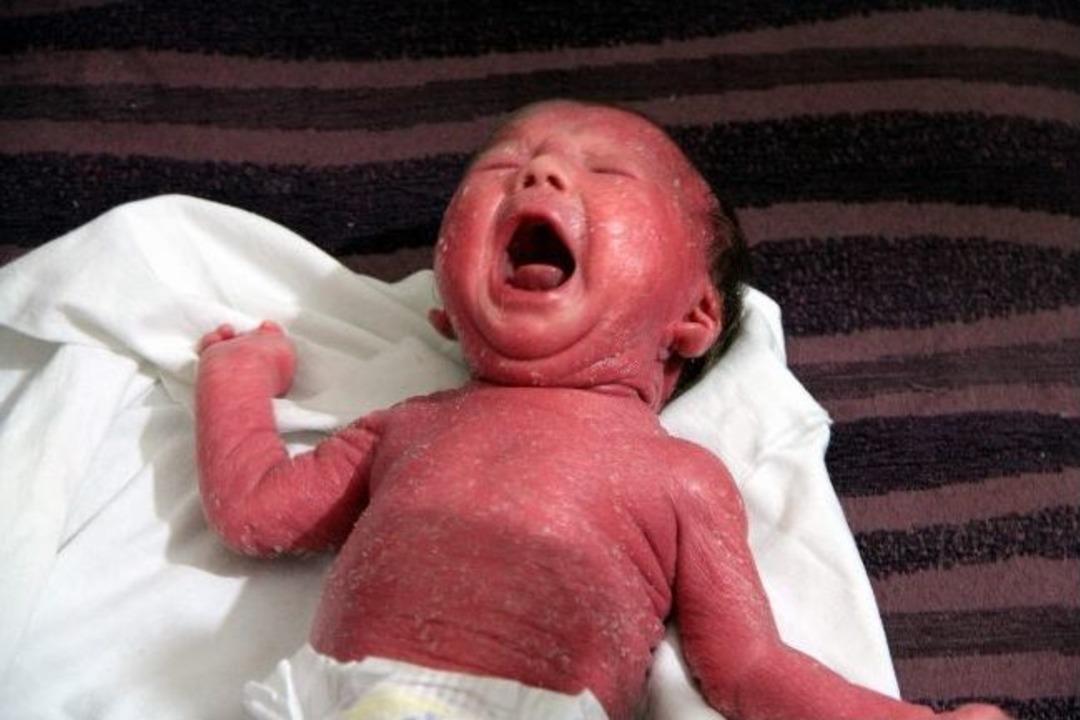 Afganlı &ccedil;ocuğun dramı