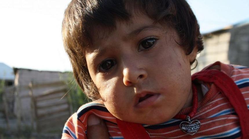 Ağrılı Aile Tedavi Masraflarının Karşılanması I&ccedil;in Yardım Bekliyor