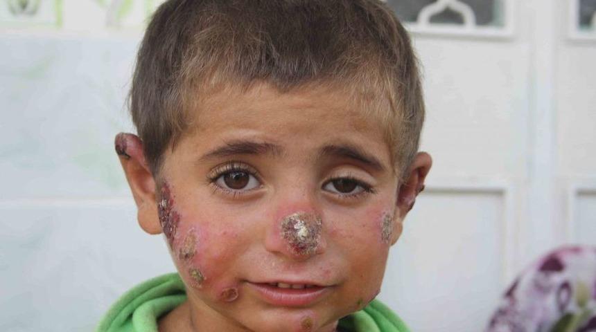 Savaşta 5 &Ccedil;ocuğu Yaralanan Suriyeli Aile Mersin'de Camiye Sığındı