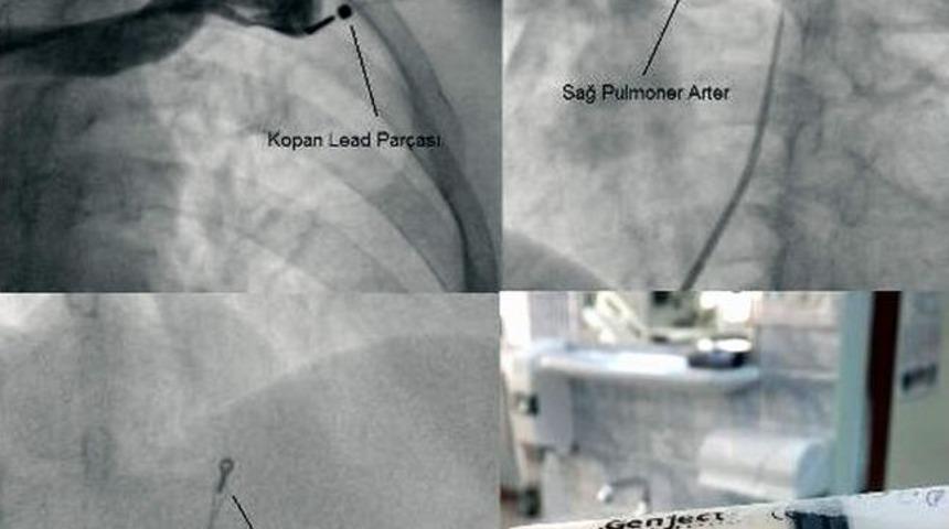 Ad&uuml; Kardiyoloji Kliniği Aydın&rsquo;da İki İlki Bir Arada Ger&ccedil;ekleştirdi