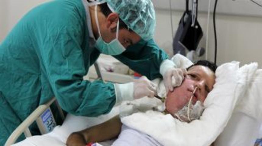 Y&uuml;z Nakli Yapılan Sert: &Ccedil;ok G&uuml;zel Olmuş, Bu Kadarını Beklemiyordum