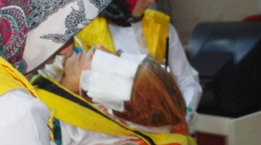 Adıyaman&rsquo;da, eşek dehşet sa&ccedil;tı: 1 ağır yaralı