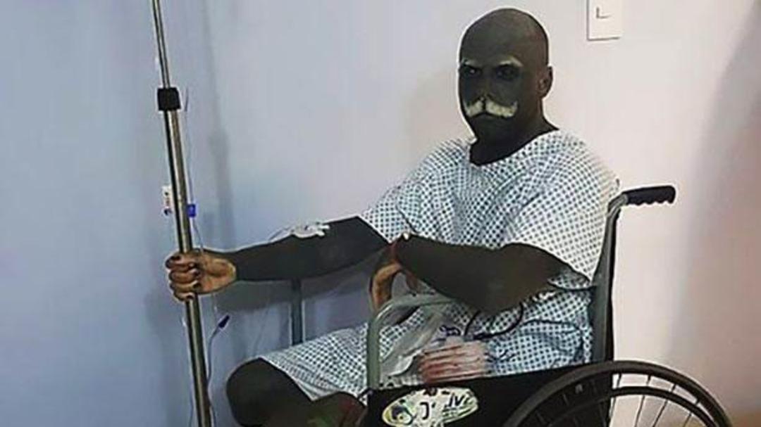 Estetik durmuyor diye cinsel organını aldırdı!