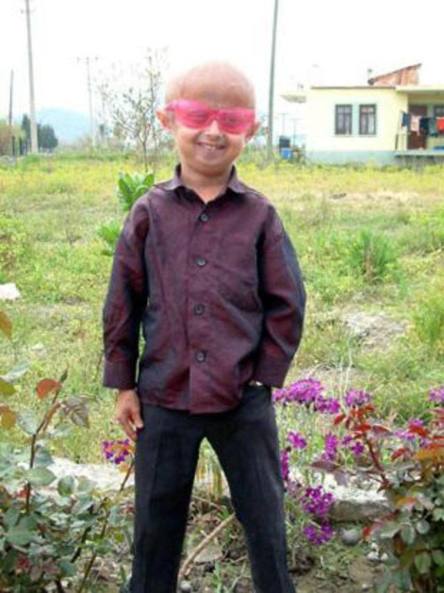 12 yaşında, yaşlılıktan &ouml;ld&uuml; 5