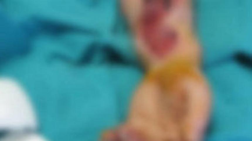 Kopan elini karnına diktiler!