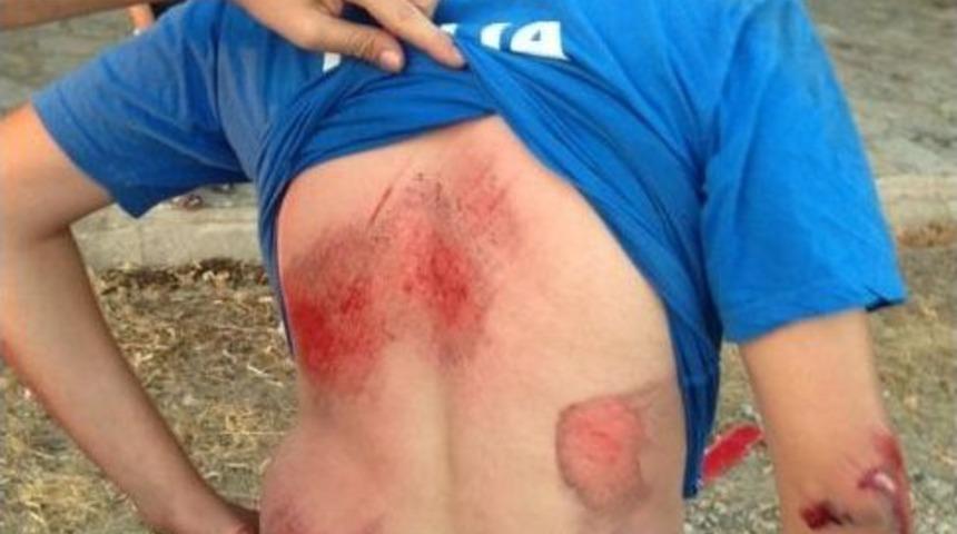 Sel&ccedil;uk'ta Kaza: 1 Yaralı