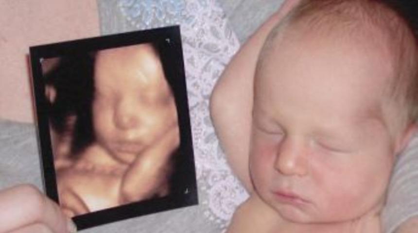 Ger&ccedil;eğe En Yakın G&ouml;r&uuml;nt&uuml;leme 4 Boyutlu Ultrason