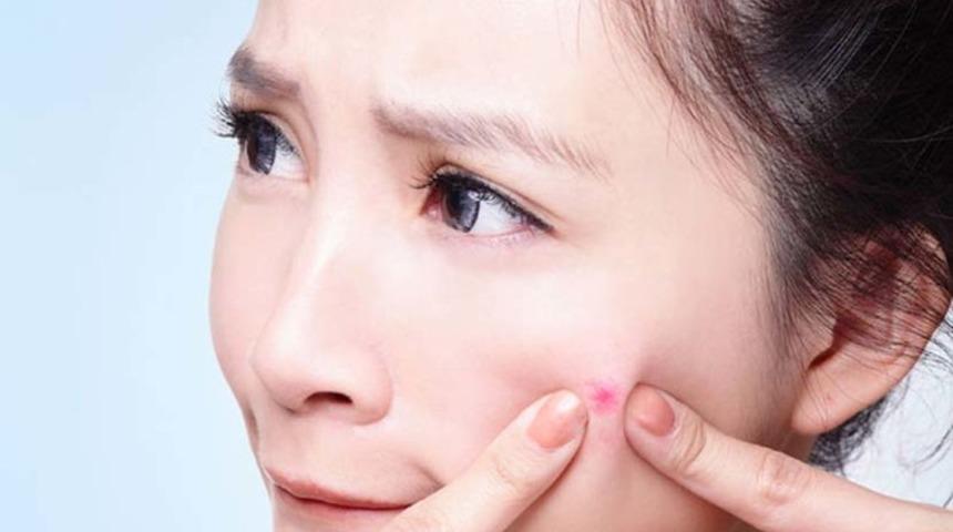 Çıban nedir, neden çıkar? Sivilceyle karıştırmayın