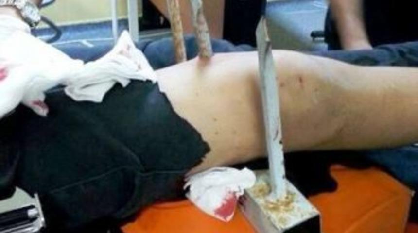 Bah&ccedil;e Duvarından Atlarken Bacağına Demir Korkuluk Battı