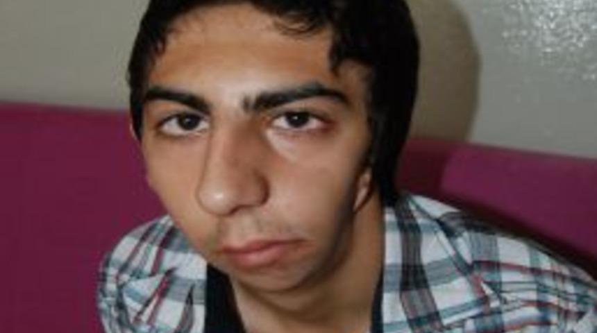 Baba Şiddetiyle Engelli Doğan Eftal, Tedavisi I&ccedil;in Yardım Bekliyor