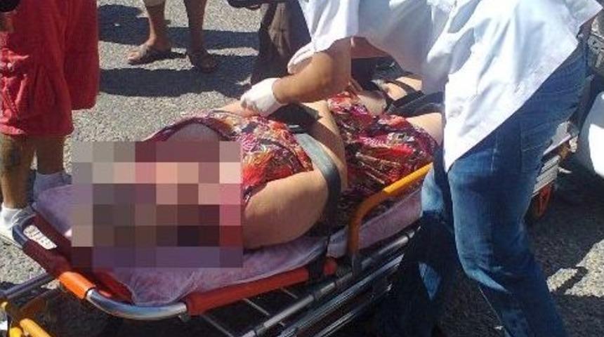 Didim&rsquo;de Elektrikli Bisikletin S&uuml;r&uuml;c&uuml;s&uuml; Kazada Yaralandı