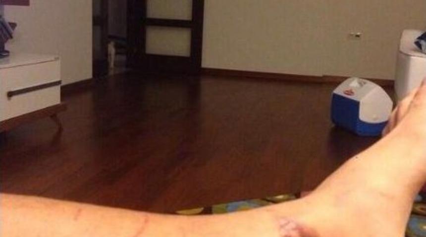 Salih Dursun&rsquo;un Ayağının Son Halini Takip&ccedil;ileriyle Paylaştı