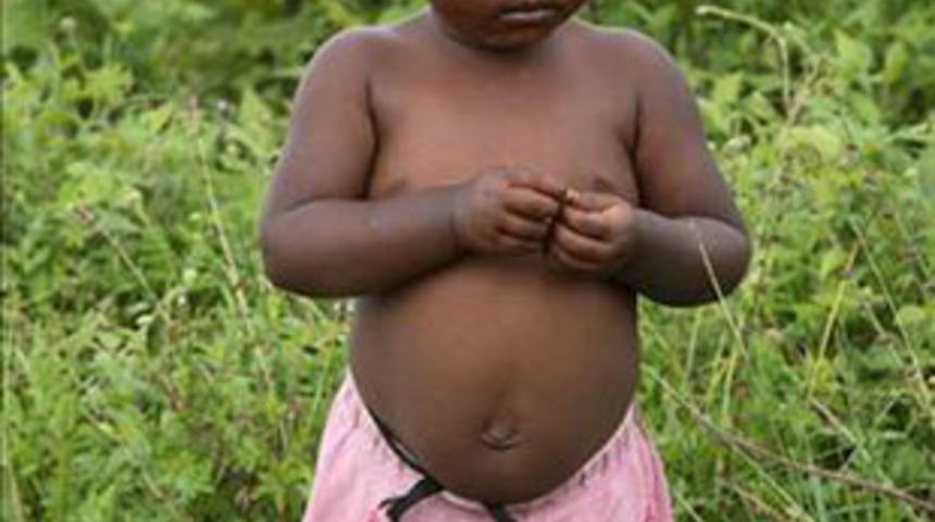 Orada nefes almak d&uuml;nyanın en zor işi!