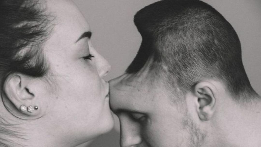  &Ccedil;ok dikkatli olun! Onu bu hale neyin getirdiğine inanamayacaksınız