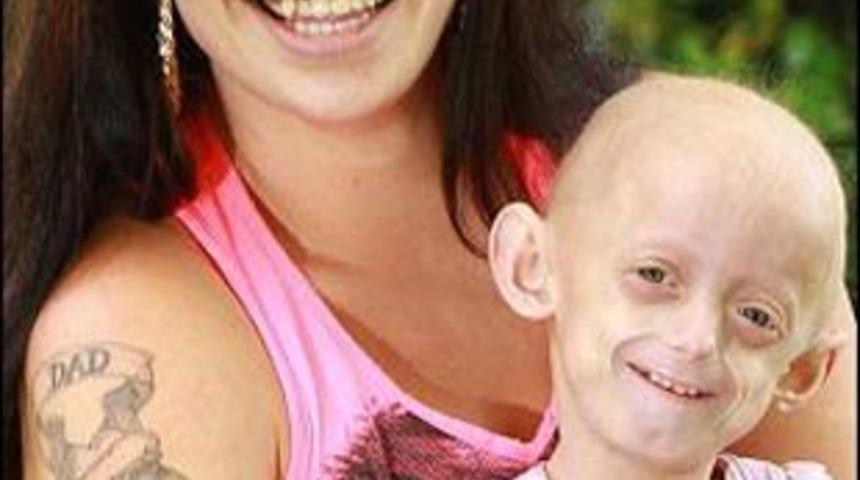 13 yaşında yaşlılıktan &ouml;lecek