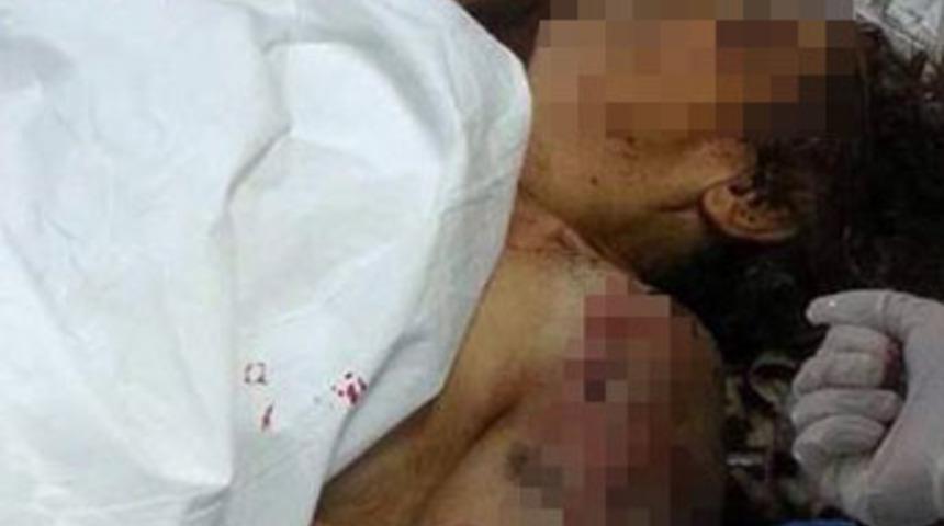 Kayseri'de k&ouml;pekler kadına saldırarak &ouml;ld&uuml;rd&uuml;