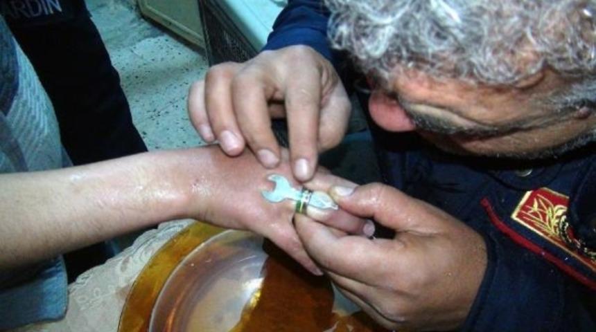 Şişen parmaktaki y&uuml;z&uuml;ğ&uuml; itfaiyeci &ccedil;ıkardı