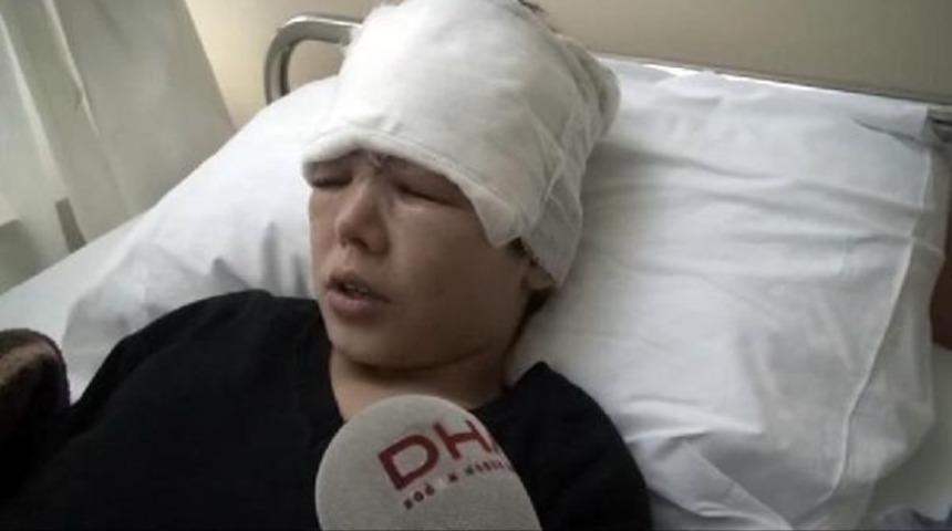 Okulda deney sırasında patlama: 2 yaralı