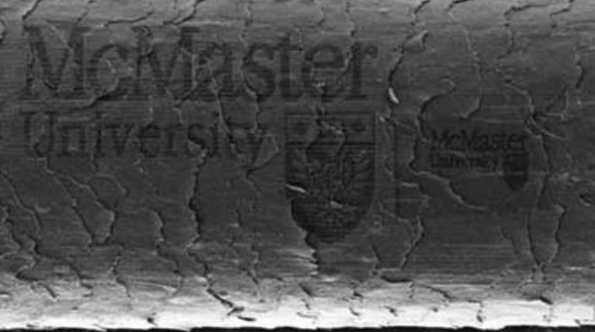 Sa&ccedil;a D&ouml;vme Yaptılar!