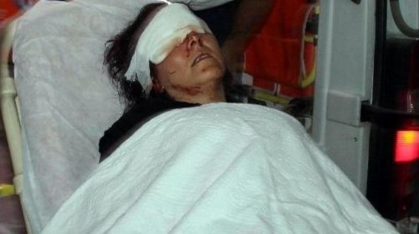 Koca Dayağı Kaşını Patlattı