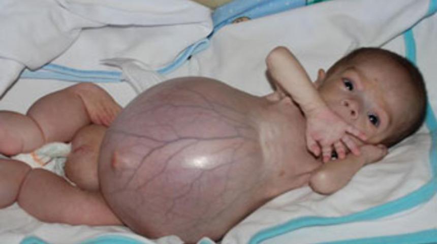 Yusuf bebekten iyi haber var