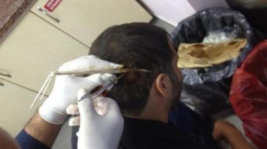 Kafasına saplanan odunla hastaneye geldi