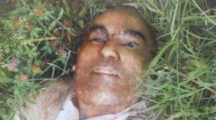 Beş Ay &Ouml;nce &Ouml;l&uuml; Bulunan Şahsın Kimliği Tespit Edilemedi