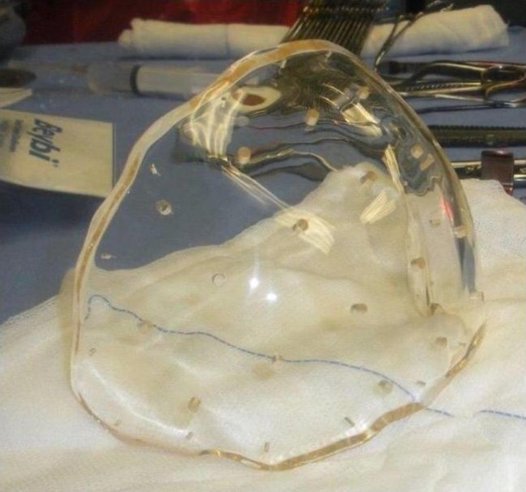 T&uuml;rk Doktorlarının Yeni Bir Başarısı