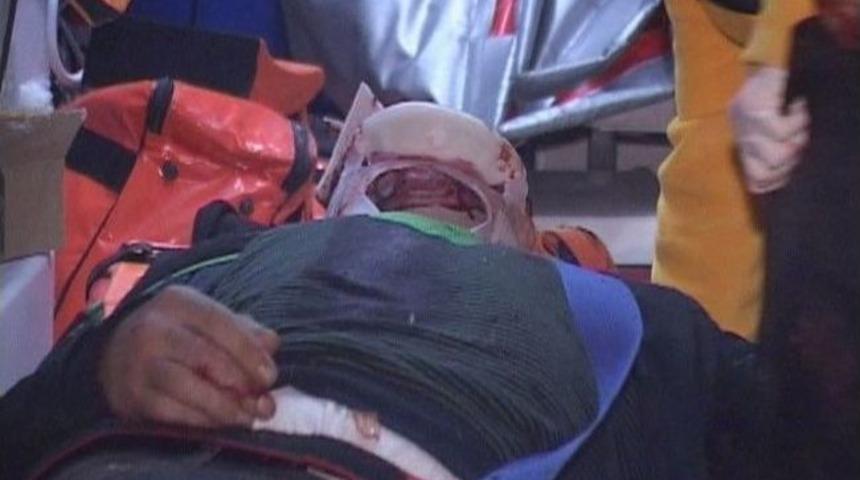 Otomobil Bah&ccedil;e Duvarına &Ccedil;arptı: 3 Yaralı