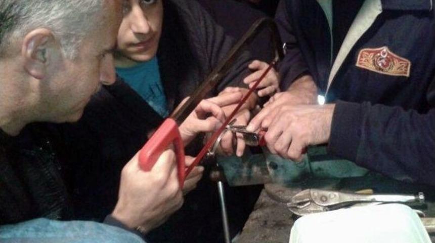 Y&uuml;z&uuml;k &Ccedil;ıkartma Operasyonu